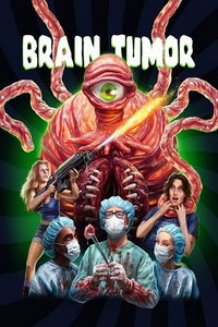 Опухоль мозга (фильм 2024) смотреть
